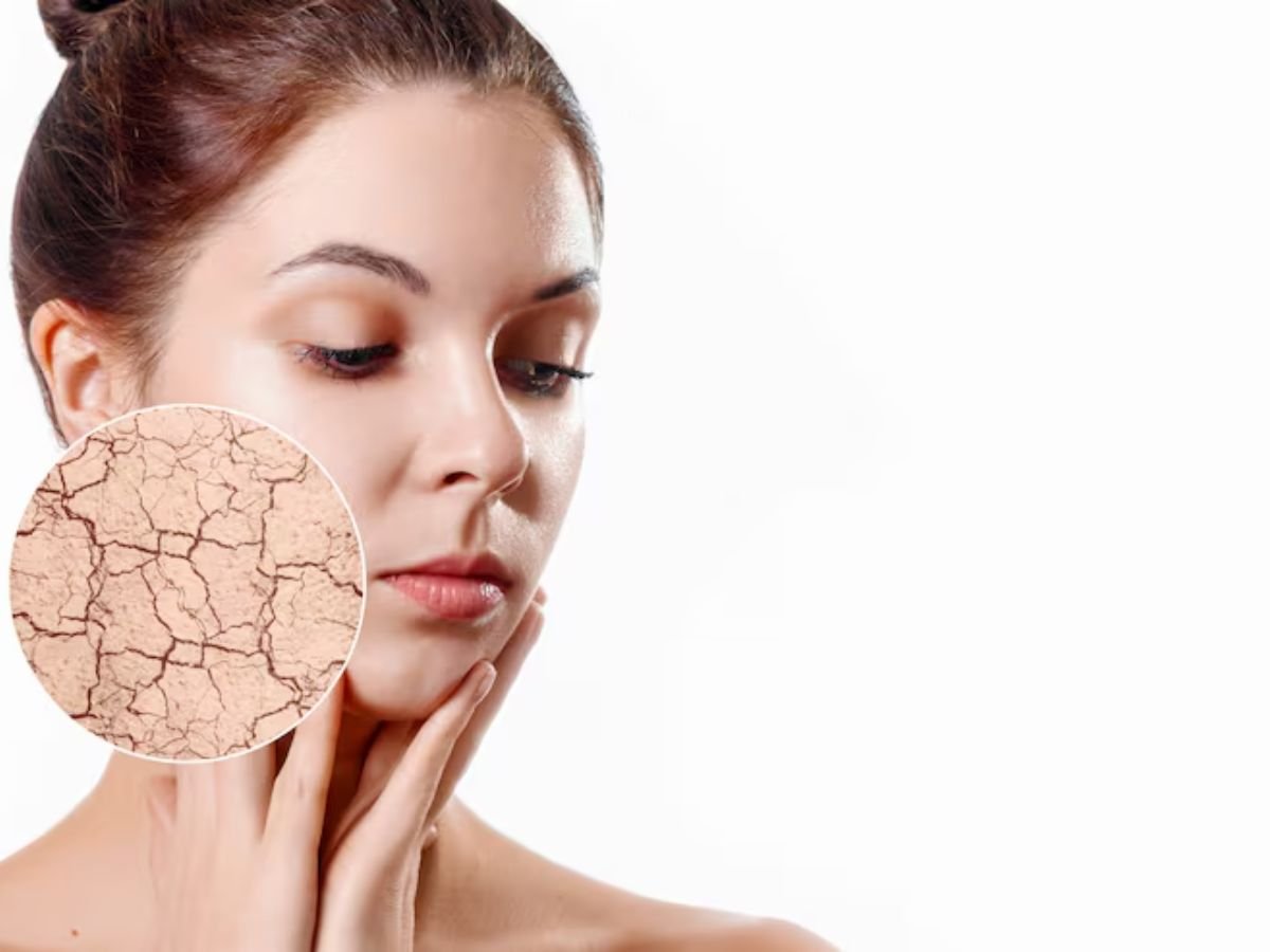 त्वचा का रूखापन और बेजान होना